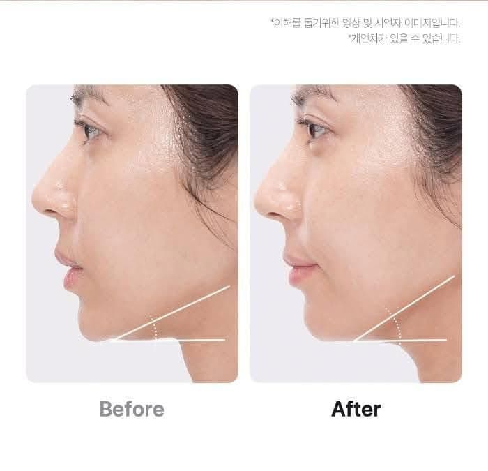 Medicube Age-R Booster Pro Jak działa urządzenie wirusowe z TikTok?