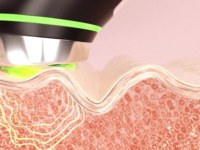 Medicube Age-R Booster Pro Jak działa urządzenie wirusowe z TikTok?