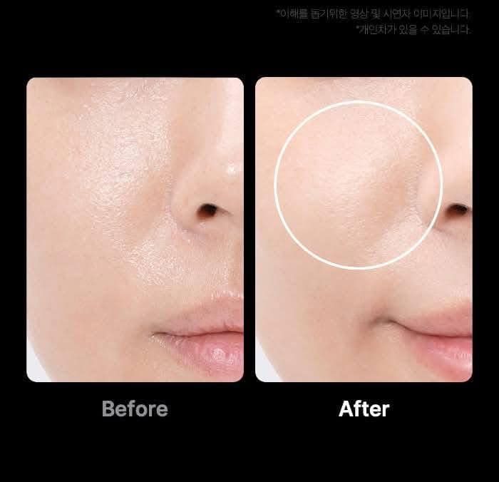 Medicube Age-R Booster Pro Jak działa urządzenie wirusowe z TikTok?