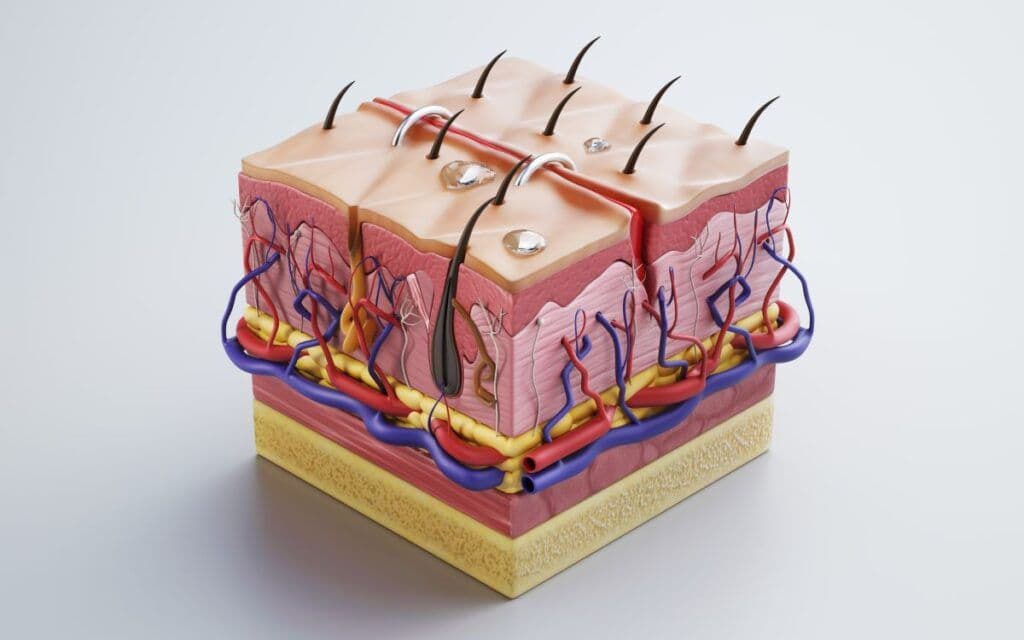 Etiologia cellulitu. Dlaczego występuje cellulit?