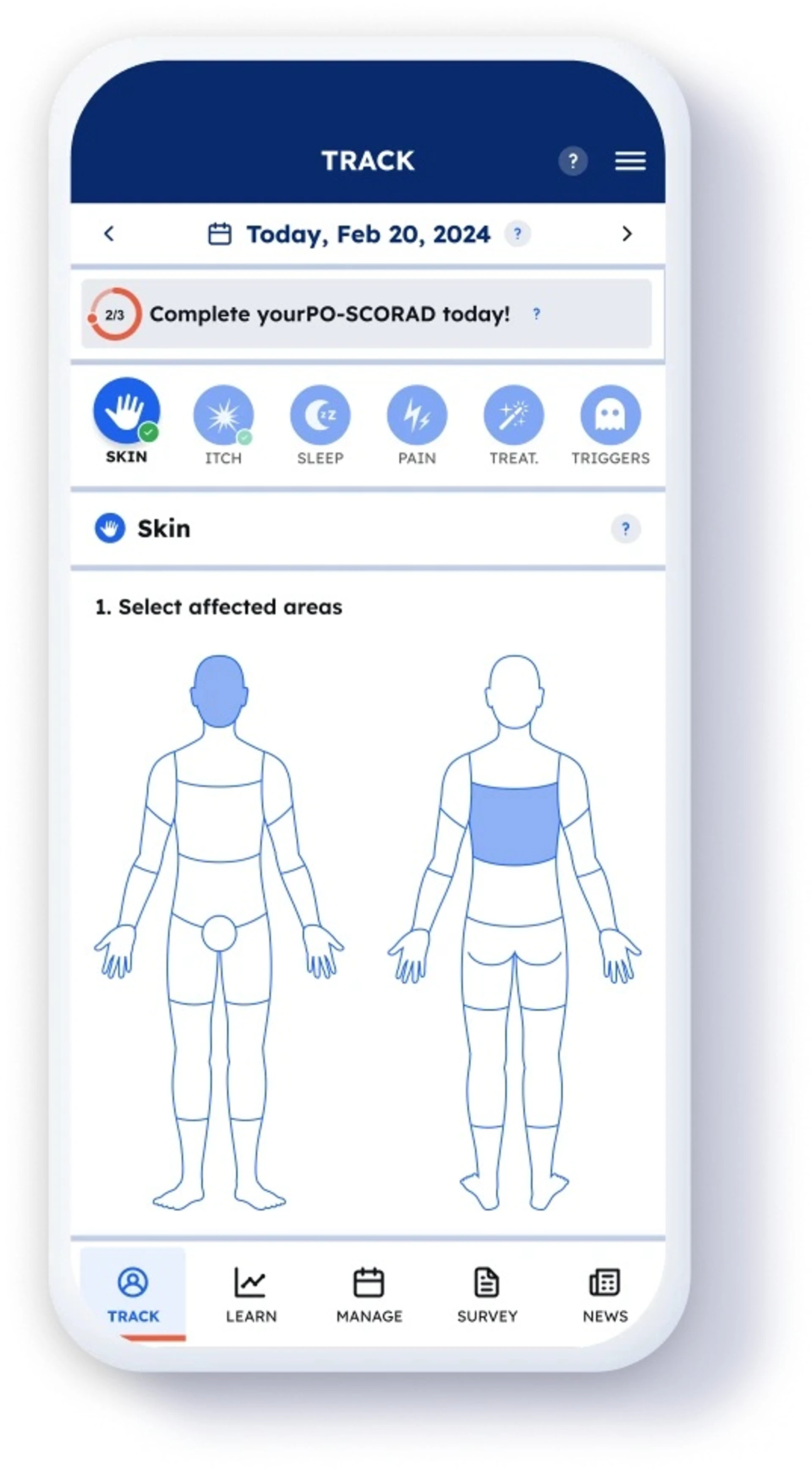 Alternatywne metody leczenia przewlekłego wyprysku rąk