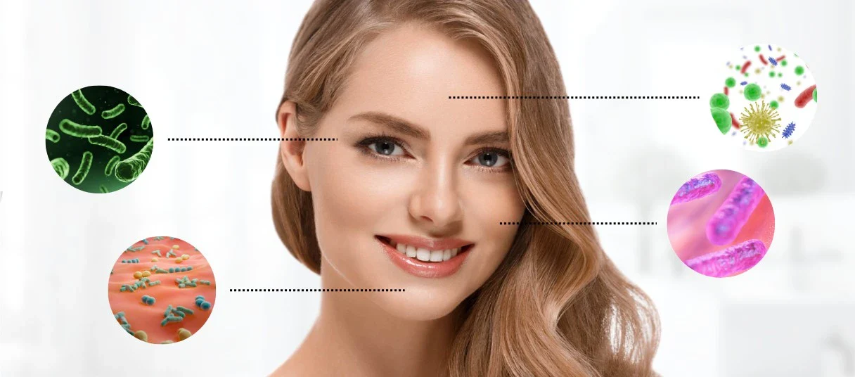 Korzyści ze stosowania probiotyków w leczeniu trądzika różowatego