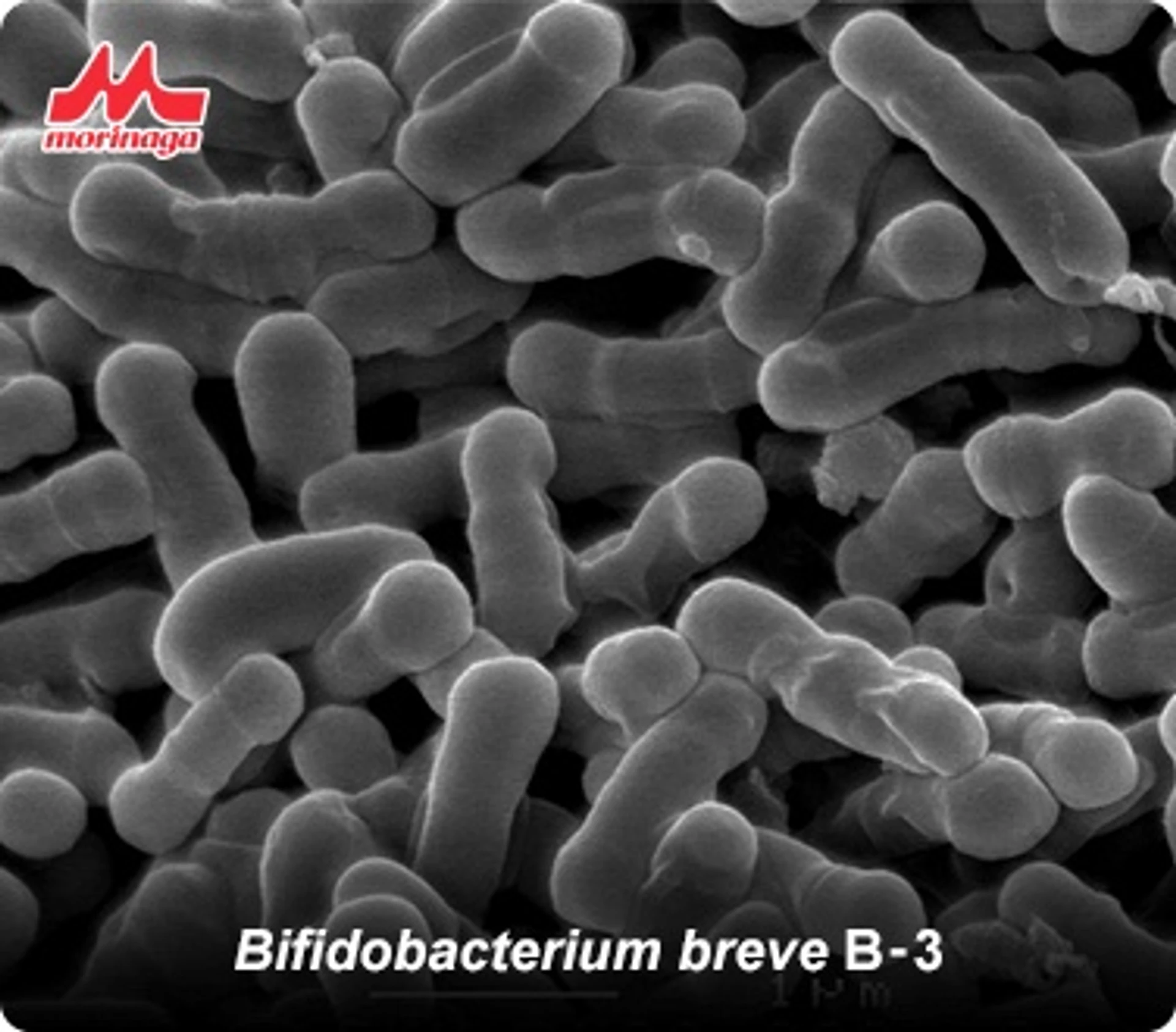 Korzyści ze stosowania probiotyków w leczeniu trądzika różowatego