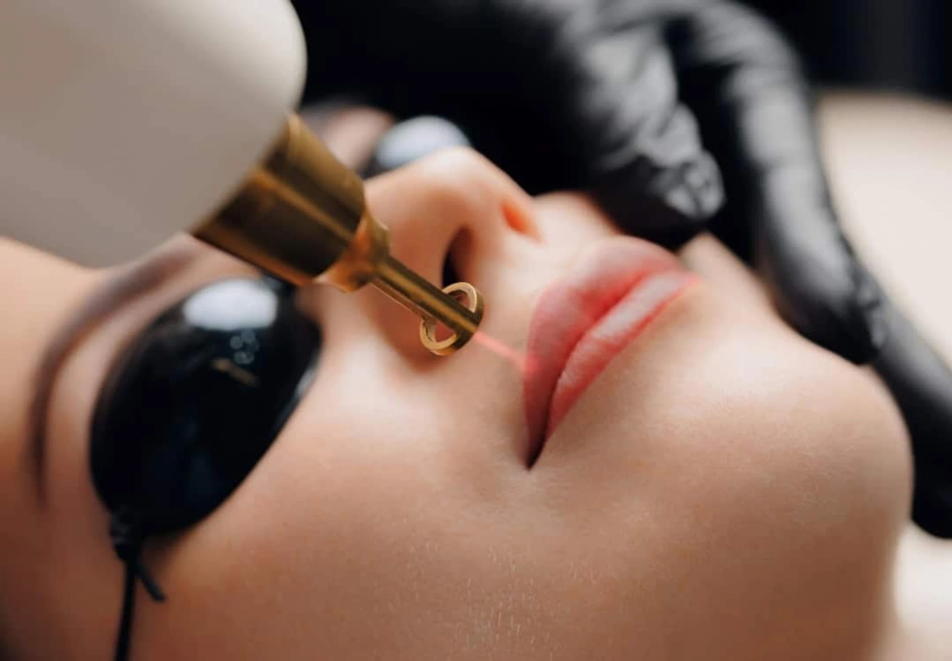 Przyczyny hiperpigmentacji ust i leczenie ciemnych warg