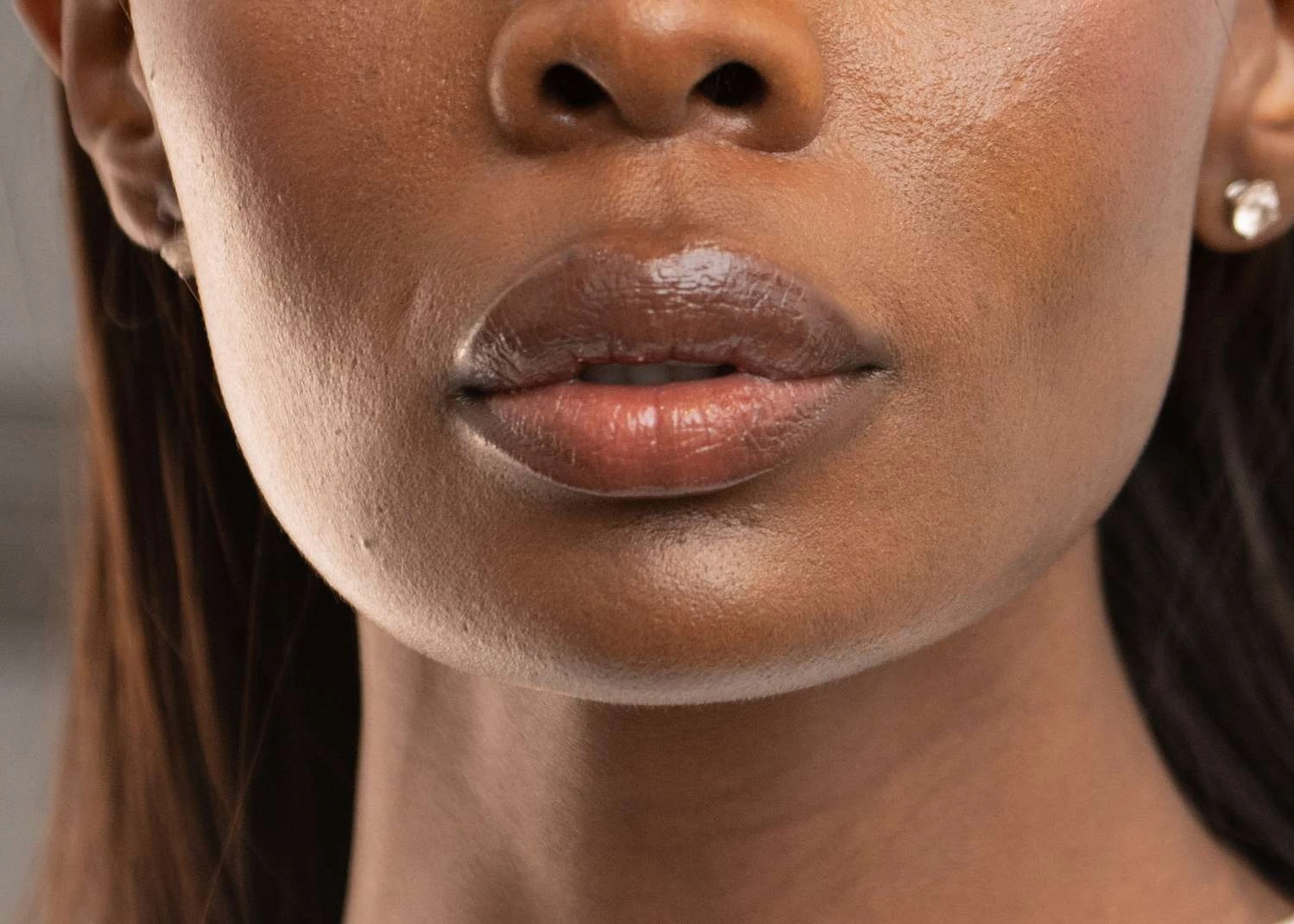 Przyczyny hiperpigmentacji ust i leczenie ciemnych warg