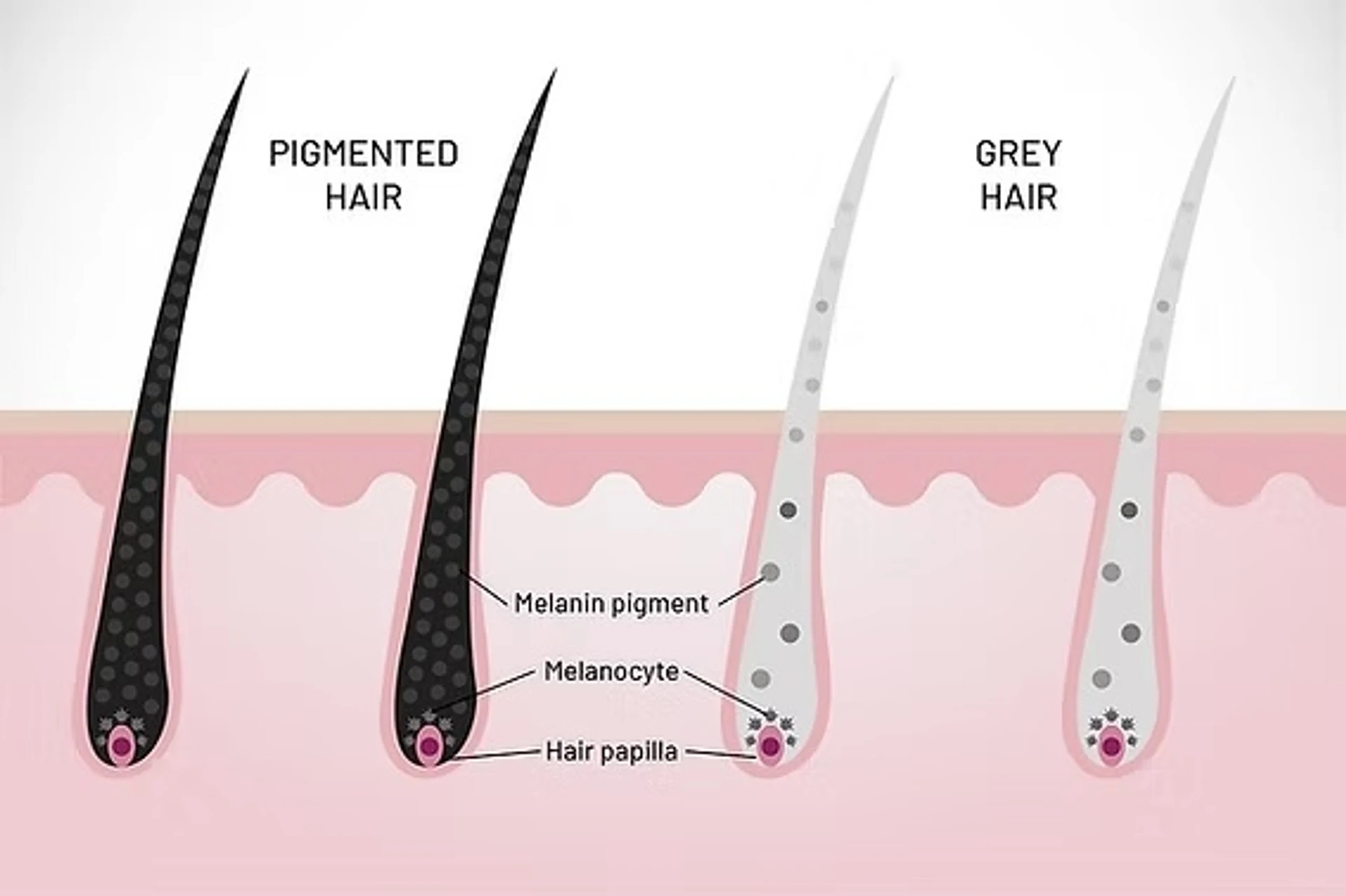 Siwe włosy: przyczyny powstawania i porady dotyczące pielęgnacji