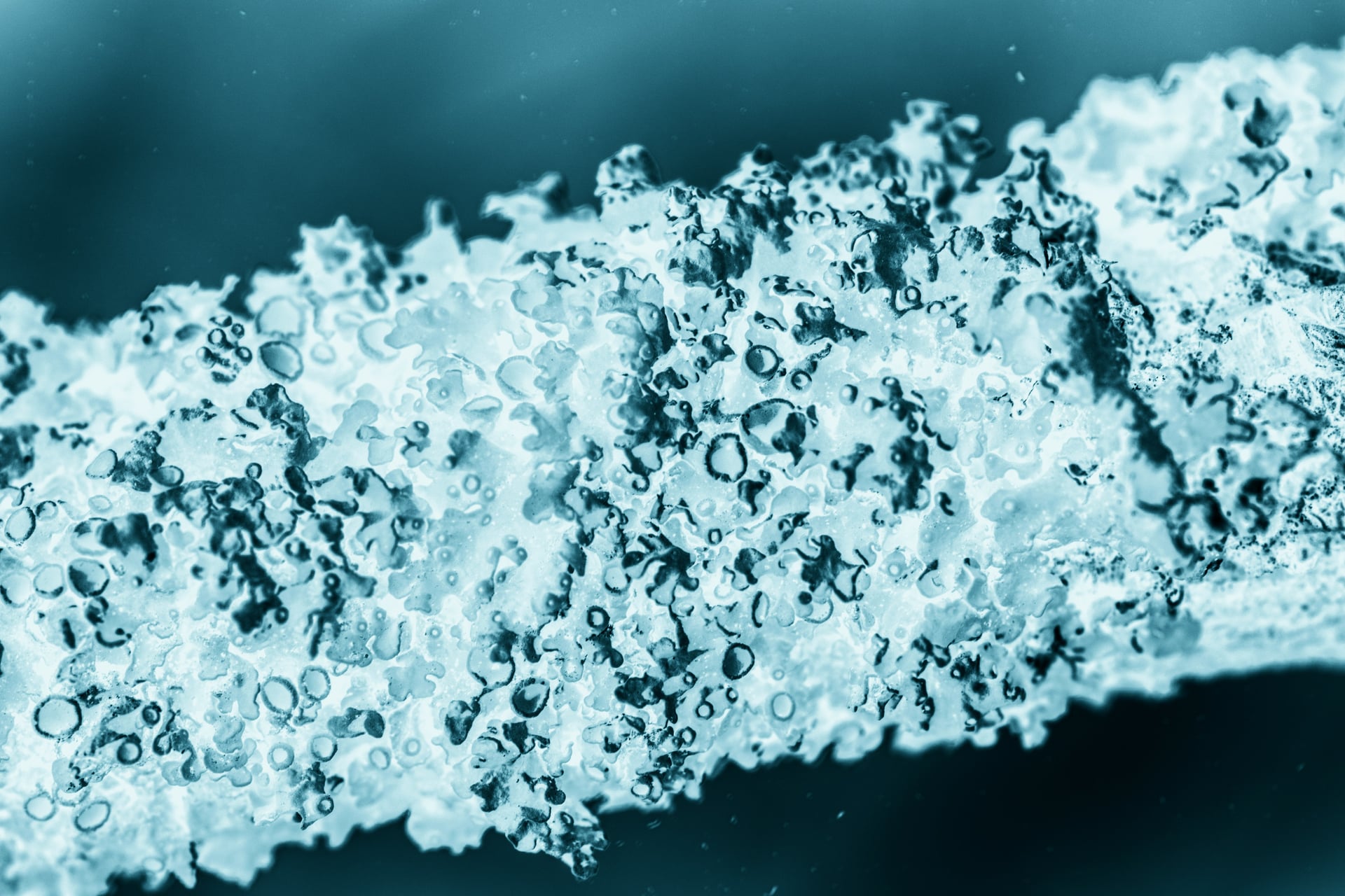 Hyaluronic acid (Kwas hialuronowy)